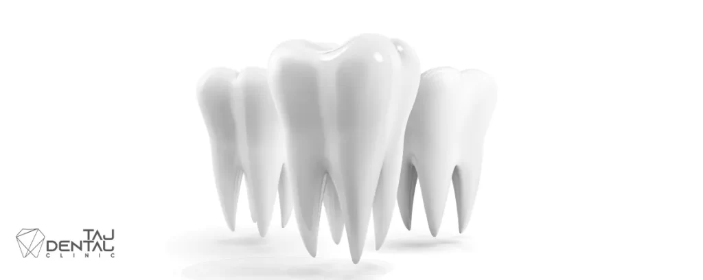 افزایش طول تاج دندان اقدسیه