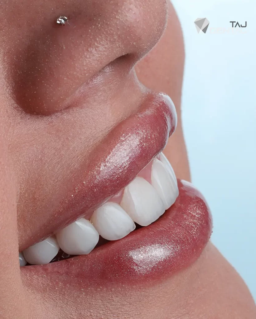 اصلاح طرح لبخند اقدسیه