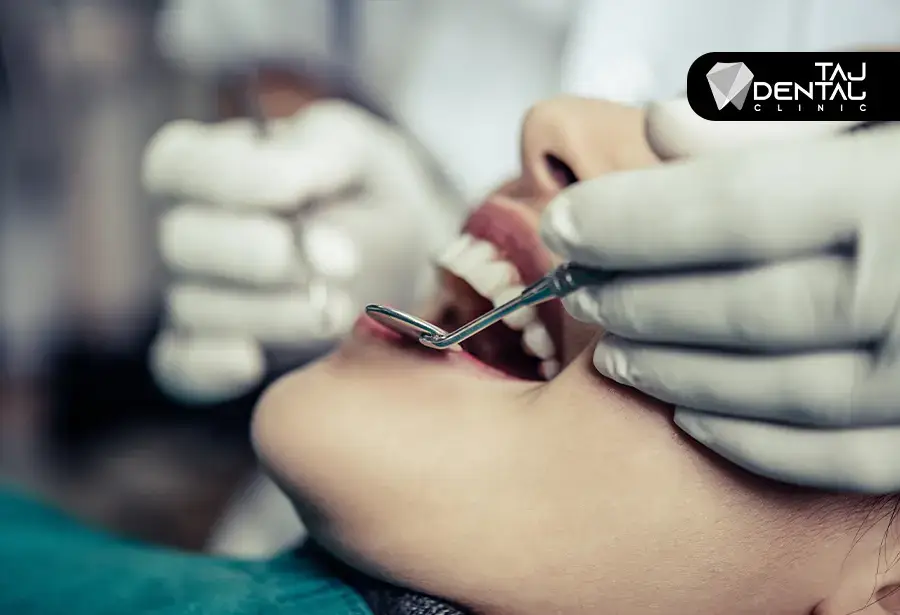 عصب کشی دندان عصب کشی دندان