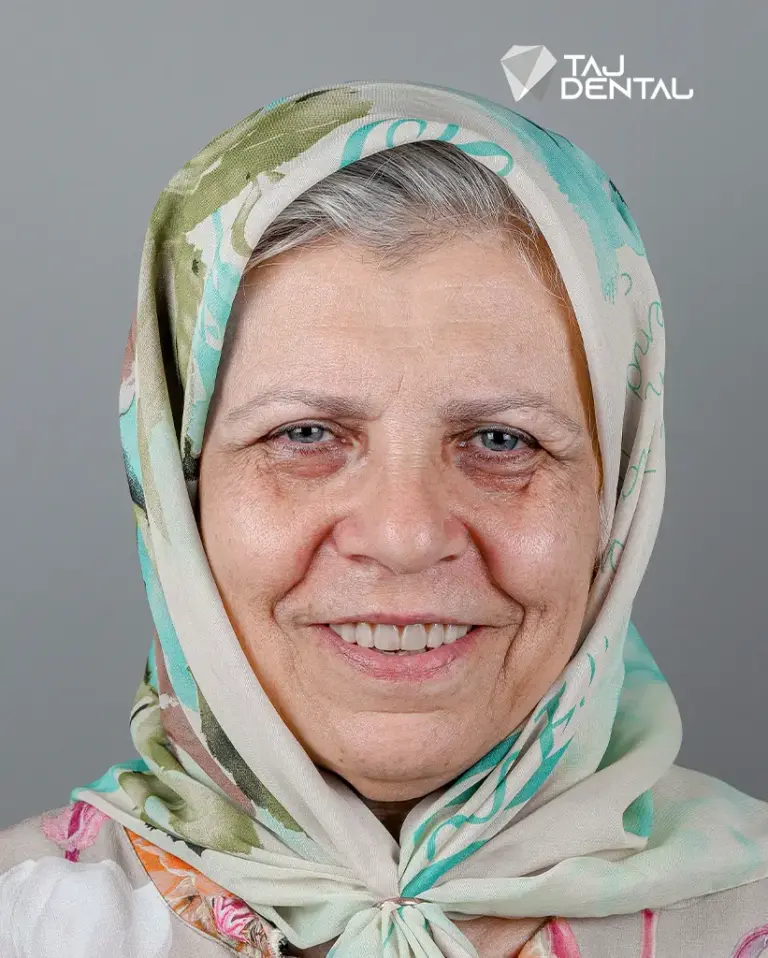 نمونه ایمپلنت دندان