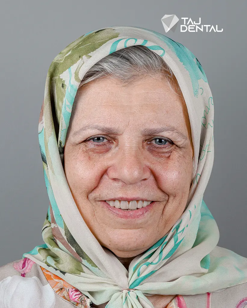 نمونه ایمپلنت دندان