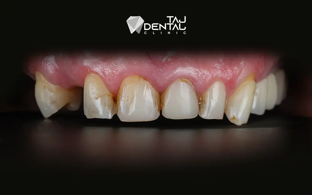 دندانپزشکی زیبایی اقدسیه دندانپزشکی زیبایی اقدسیه