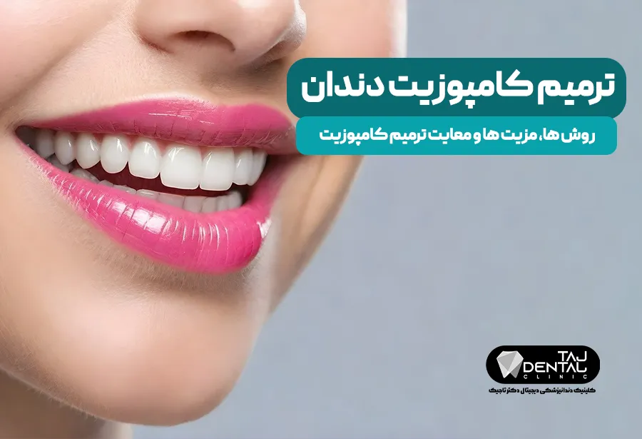 ترمیم کامپوزیت دندان