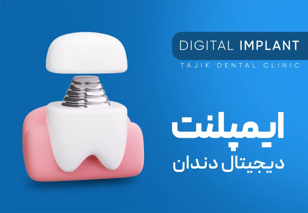 ایمپلنت دیجیتال دندان