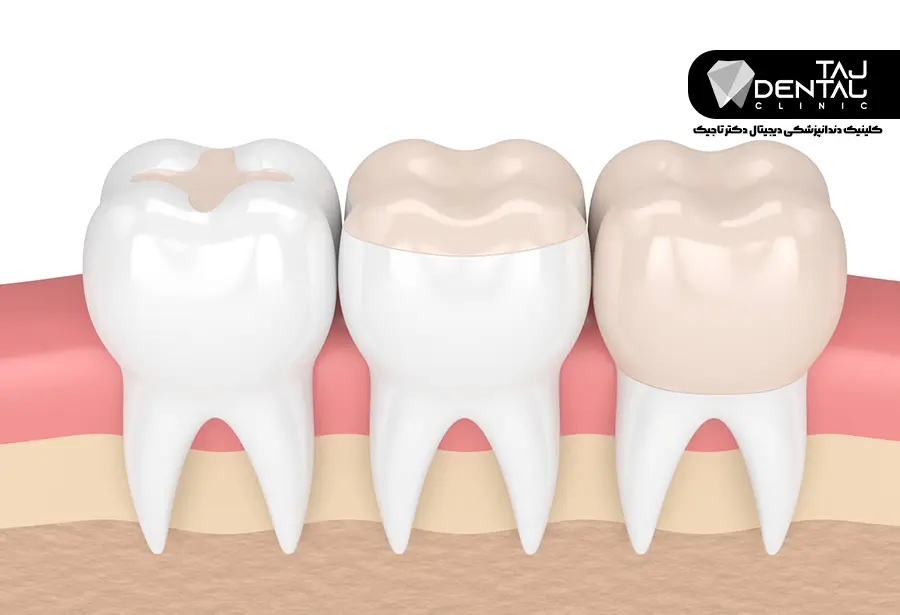 دندانپزشکی بیومیمتیک