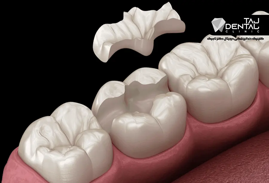 دندانپزشکی بیومیمتیک