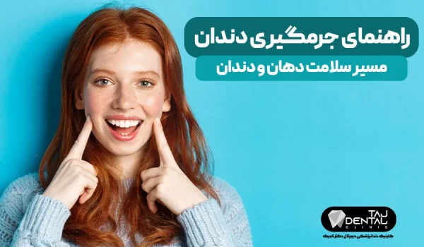 راهنمای جرمگیری دندان