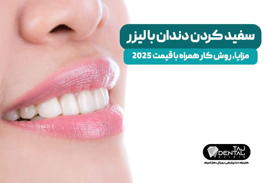سفید کردن دندان با لیزر