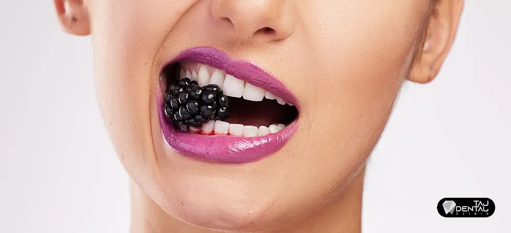غذاهای مناسب برای لمینت دندان