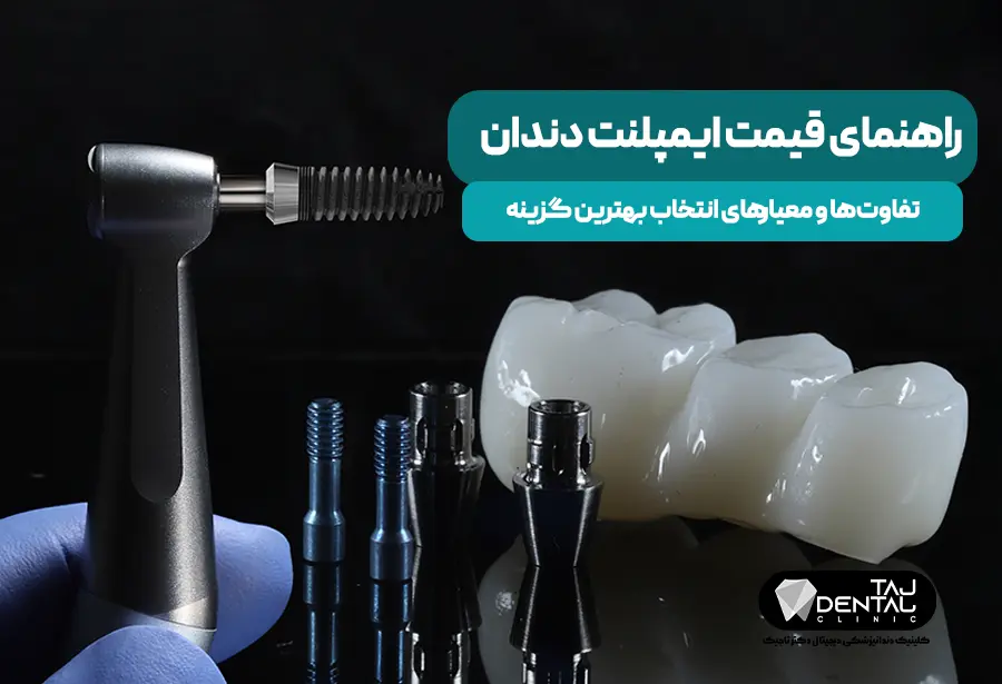 قیمت ایمپلنت دندان
