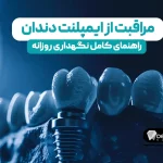 مراقبت از ایمپلنت دندان