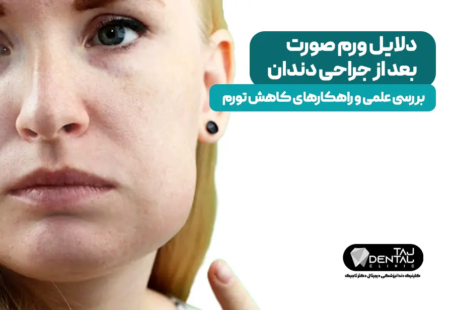 ورم صورت بعد از جراحی دندان