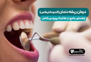 درمان ریشه دندان