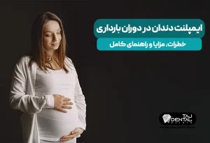 ایمپلنت دندان در دوران بارداری