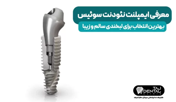 ایمپلنت نئودنت