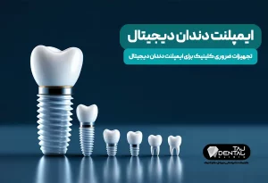 تجهیزات ایمپلنت دندان دیجیتال