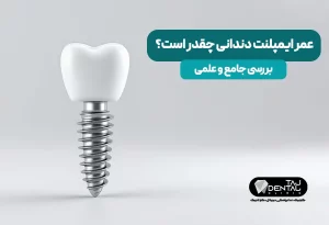 عمر ایمپلنت دندان
